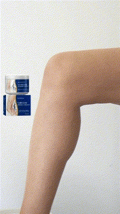 VARICOSE VEINS🐍TRATAMIENTO PARA VARICES 👩🏽‍🦱🧔🏻